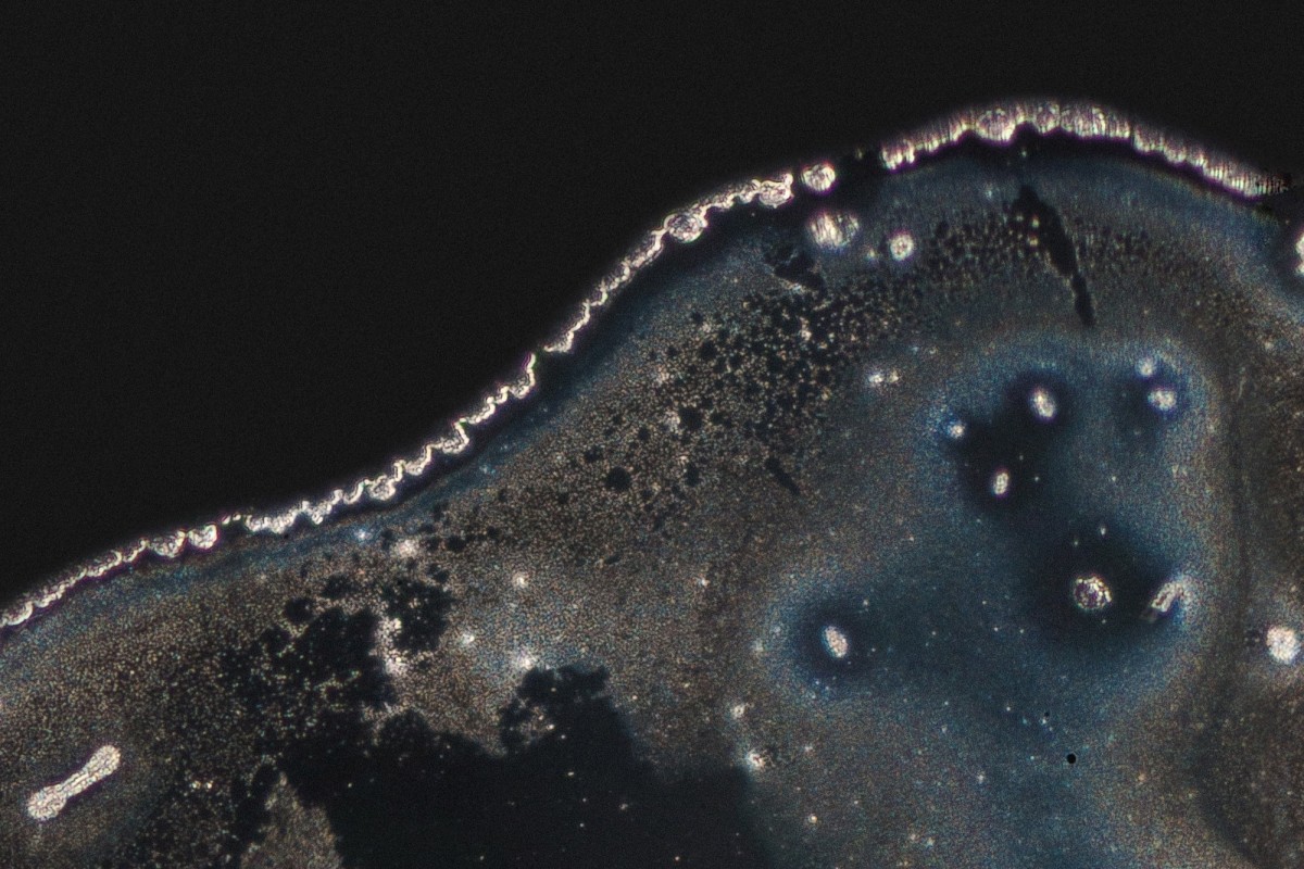 LSD Crystals ∅ Cross polarisation microscope with 200x enlargement.